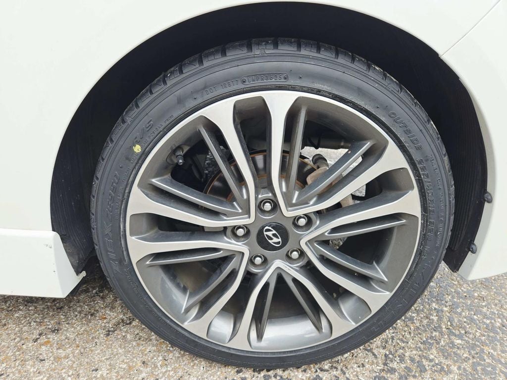 2017 Hyundai Veloster Turbo